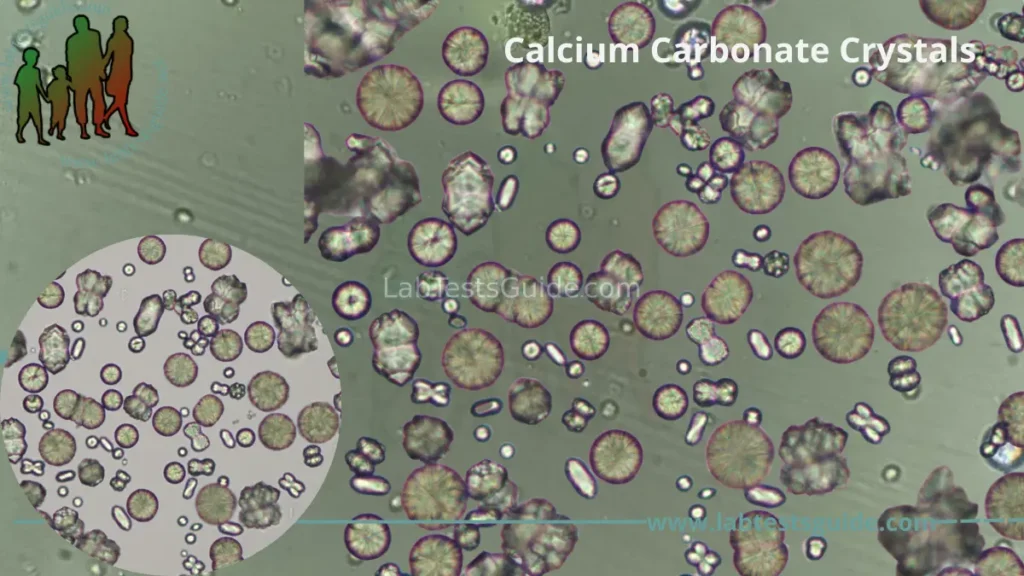 Calcium Carbonate Crystals