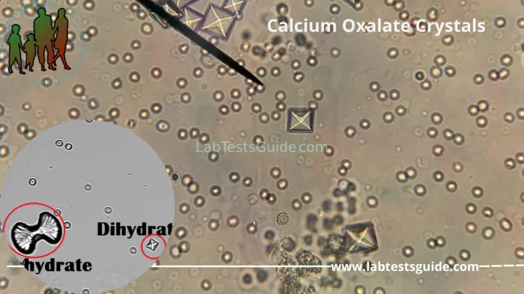 Calcium Oxalate Crystals