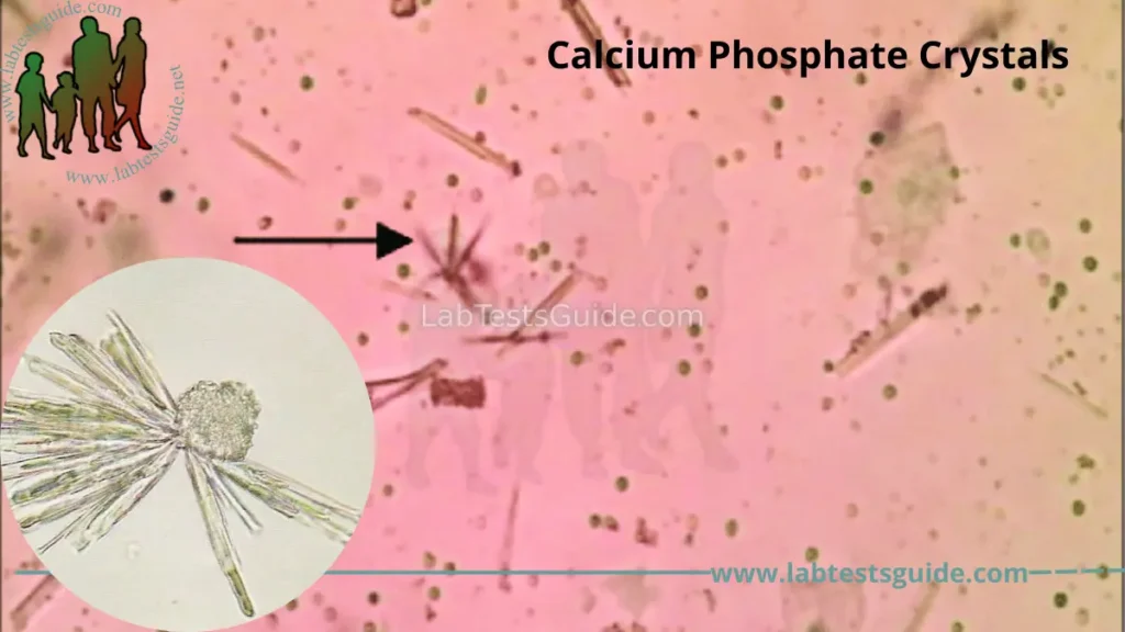 Calcium Phosphate Crystals