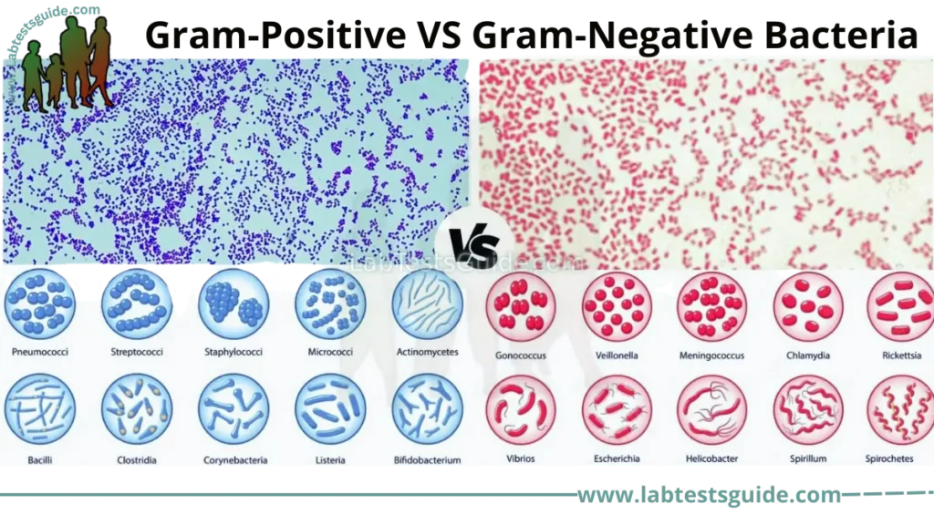Difference Between Gram-Positive and Gram-Negative Bacteria