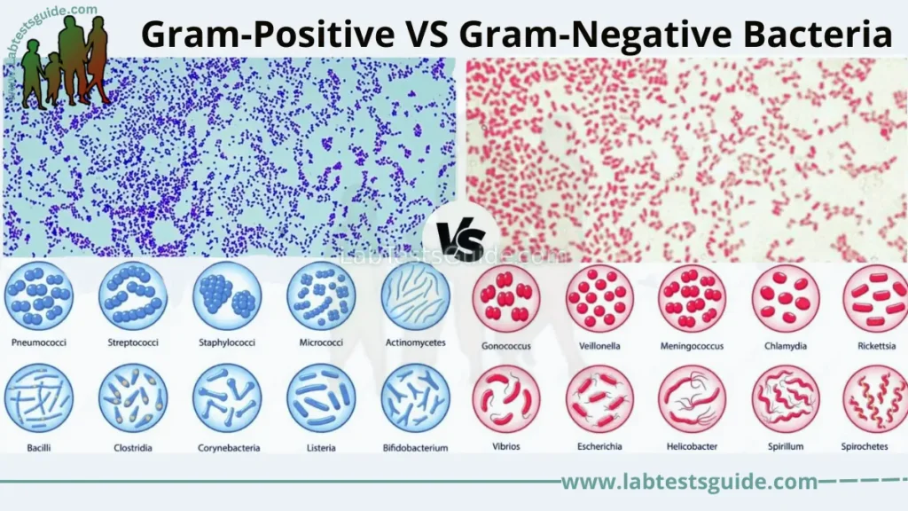 Gram Positive VS Gram Negative Bacteria