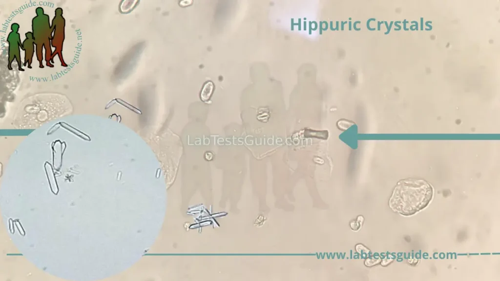 Hippuric Crystals