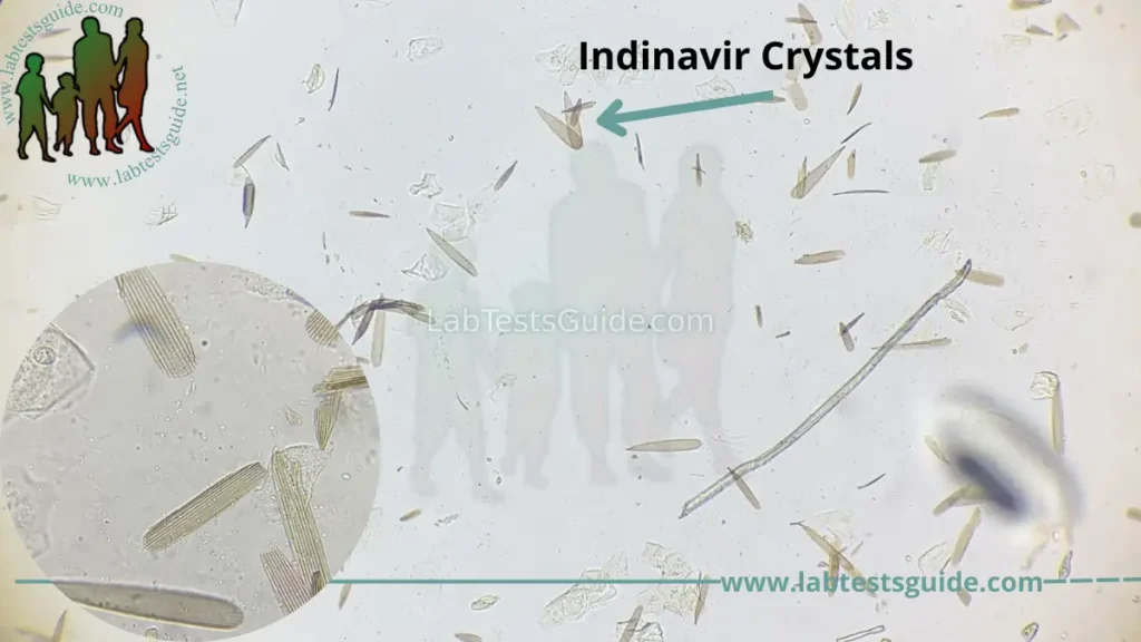 Indinavir Crystals
