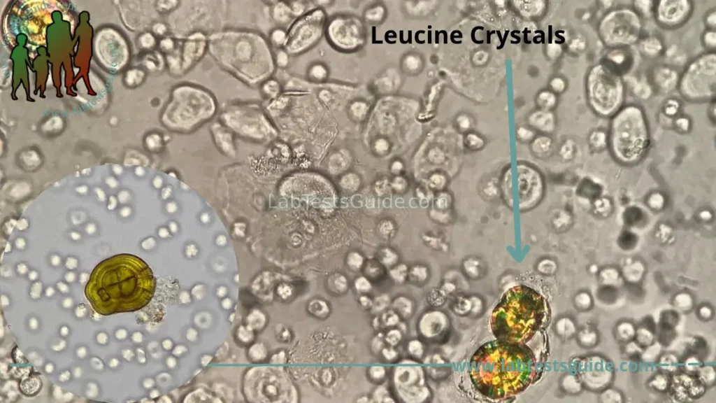 Leucine Crystals