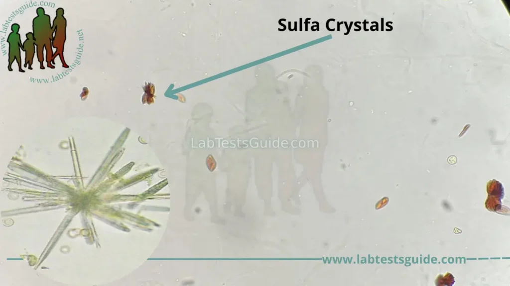 Sulfa Crystals