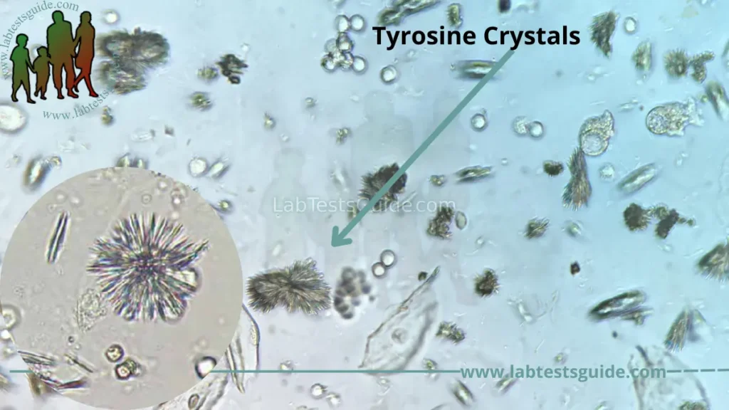 Tyrosine Crystals