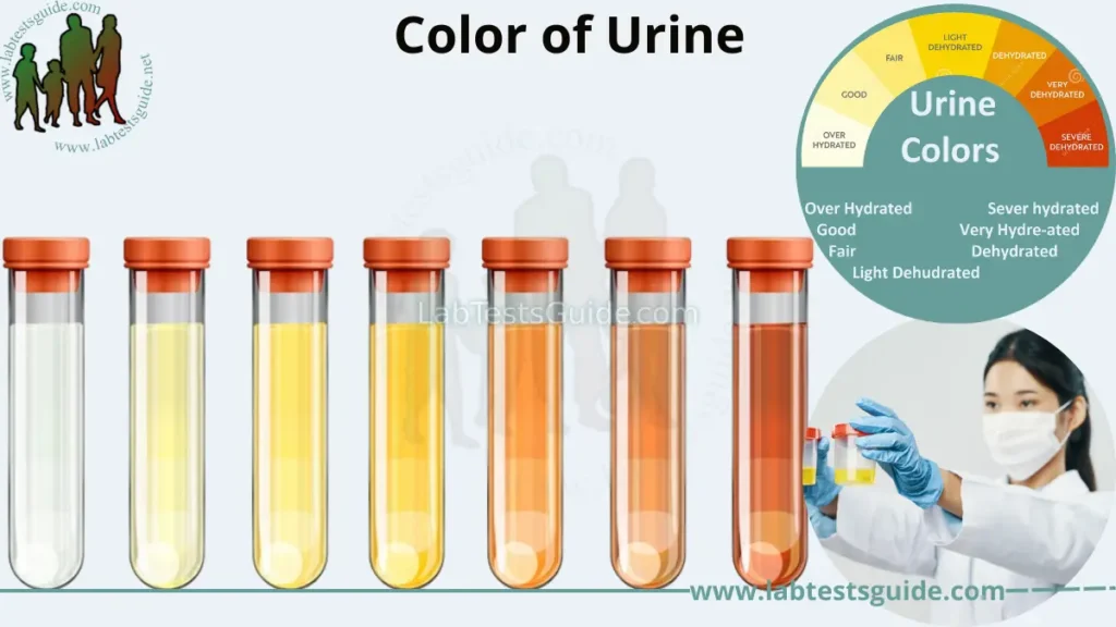 Color of Urine