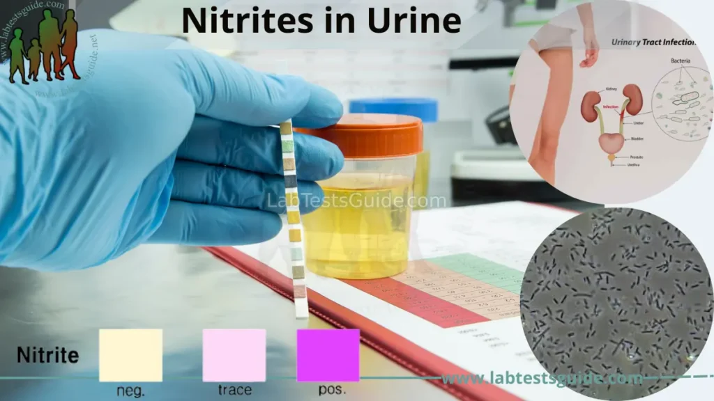 Nitrites in Urine
