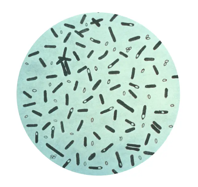 Bacterial Spores Structure, Importance and examples | Lab Tests Guide