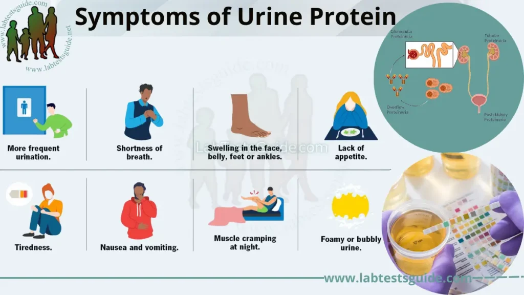 Urine Protein  Lab Tests Guide