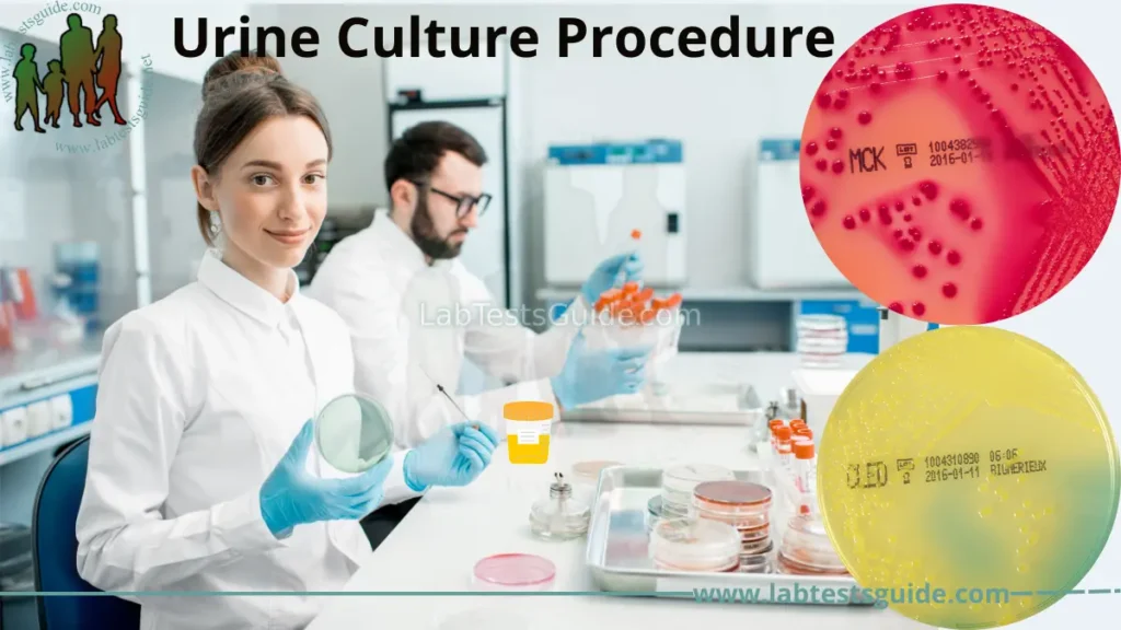 Urine Culture Procedure