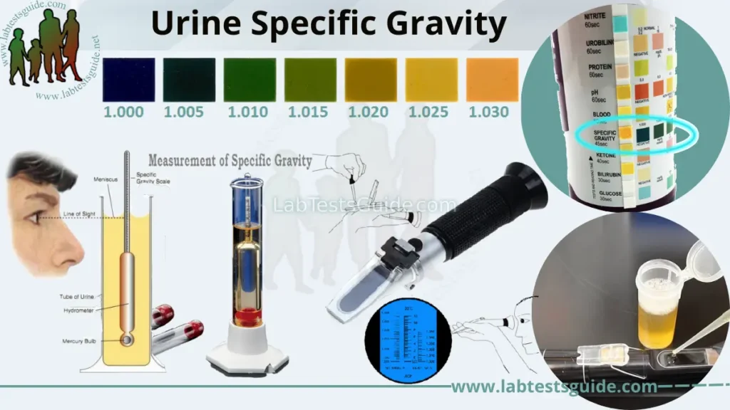 Urine Specific Gravity