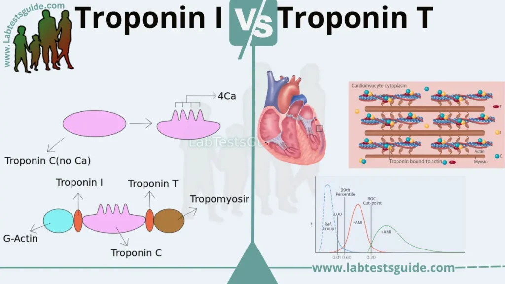 Difference Between Troponin I and Troponin T