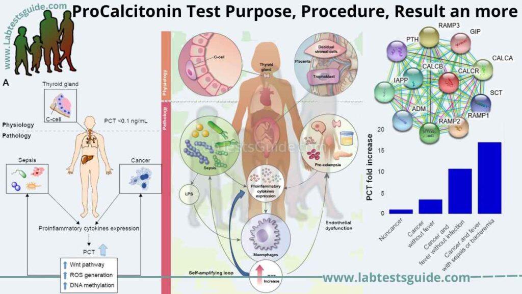 ProCalcitonin (PCT) Test Purpose, Procedure, Result an more