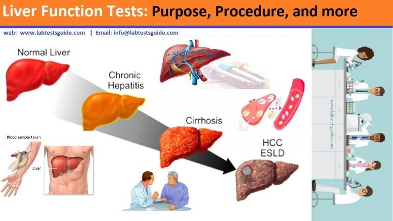 Liver Function Tests: Purpose, Procedure, and more | Lab Tests Guide