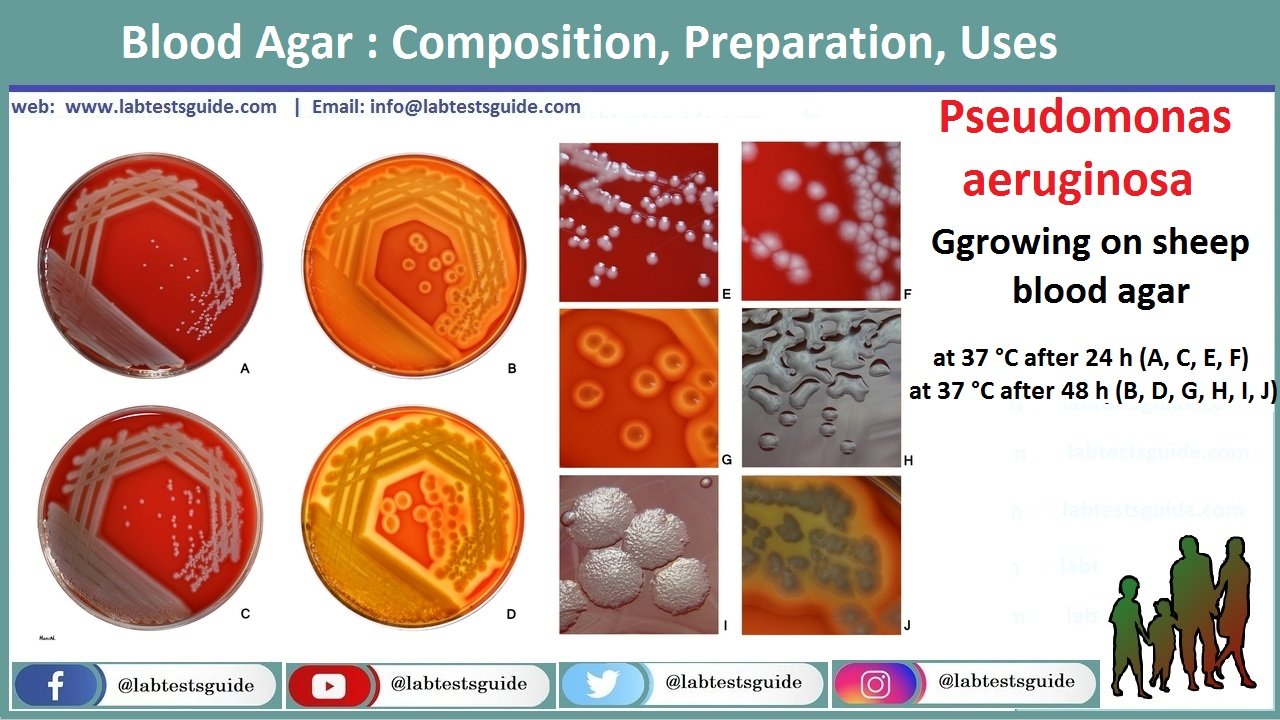 Blood Agar Composition, Preparation, Uses Lab Tests Guide