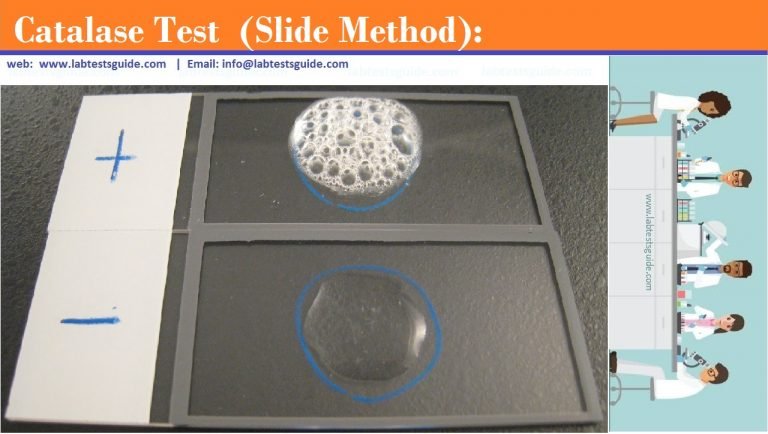 catalase-test-principle-procedure-results-and-more-lab-tests-guide