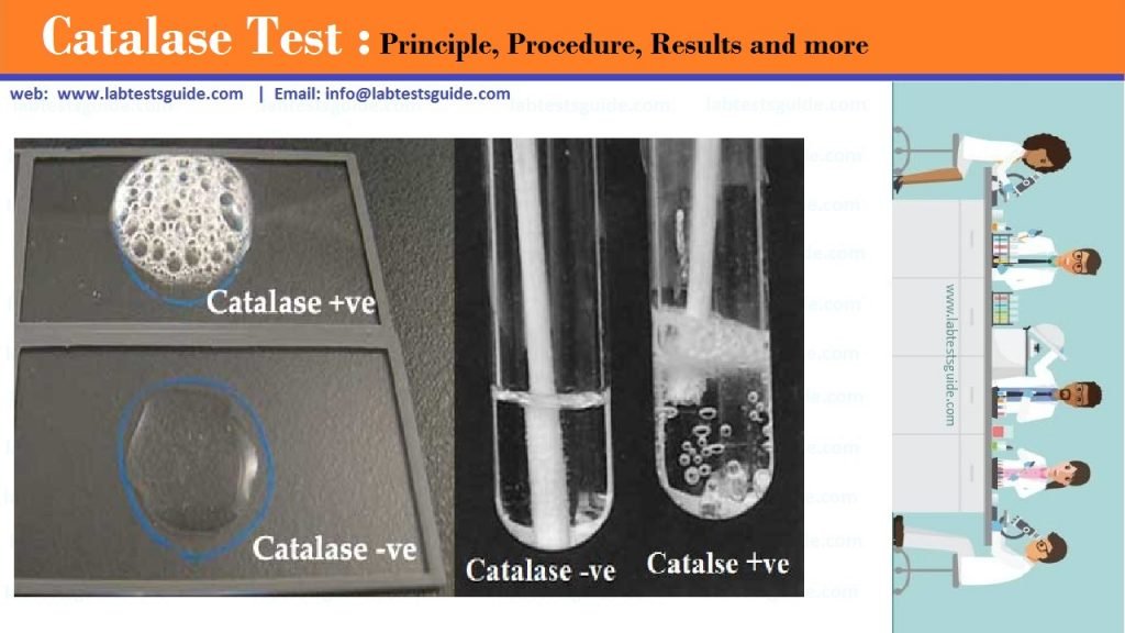 Catalase Test Procedure Archives Lab Tests Guide