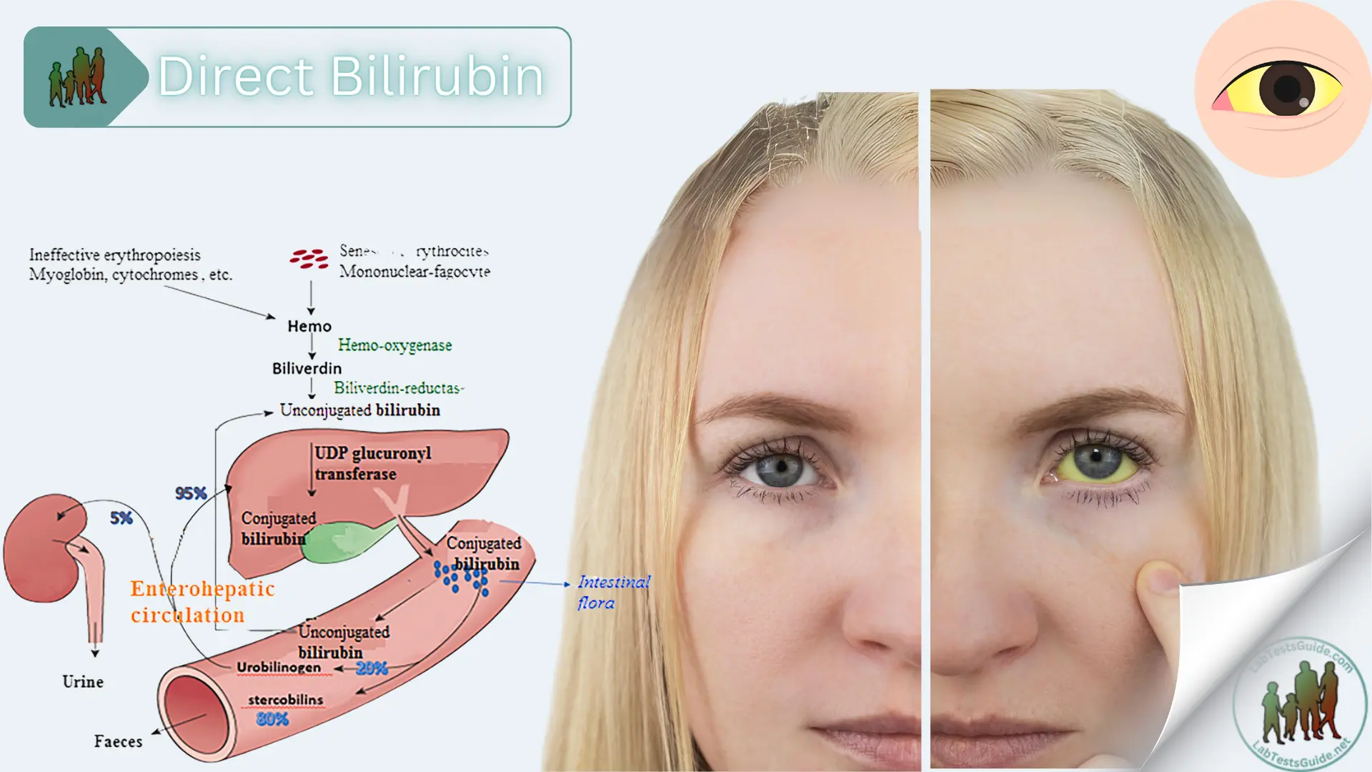 Direct Bilirubin Test Purpose, Procedure, Result and more | Lab Tests Guide