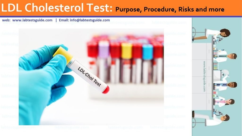 LDL Cholesterol