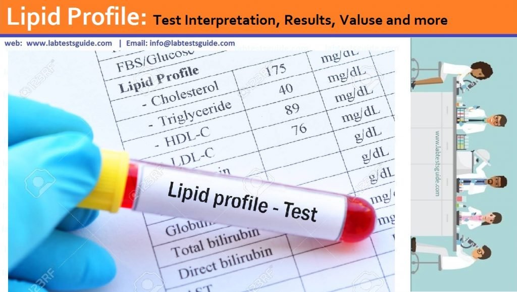 Lipid Profile Chart