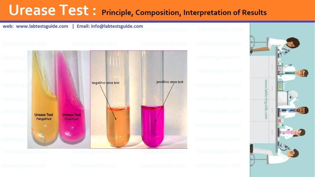 Urease Test Principle, Composition, Interpretation of Results Lab Tests Guide