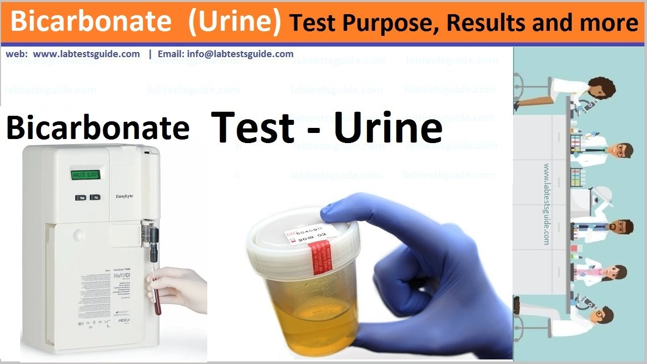 urine sodium normal range
