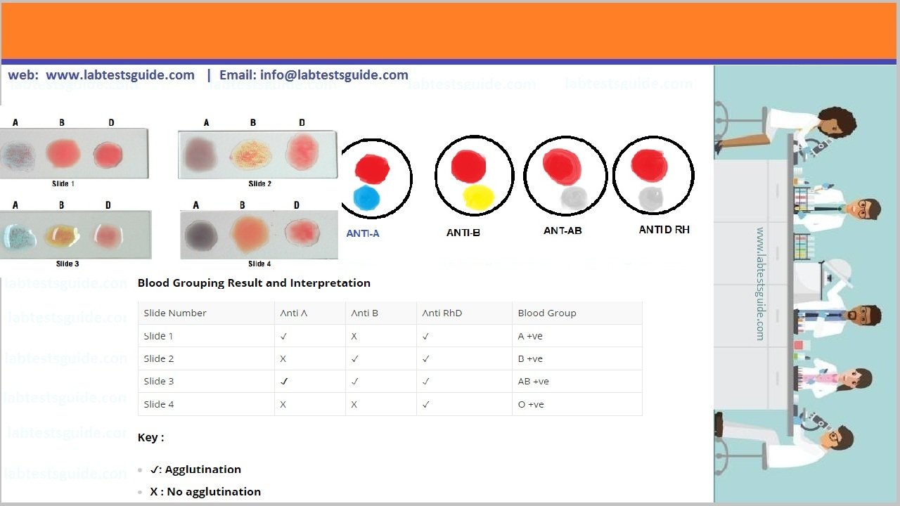 Leukemia Blood Test Results Chart