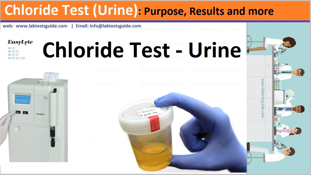 Chloride Urine Test Purpose Result And More Lab Tests Guide 7482
