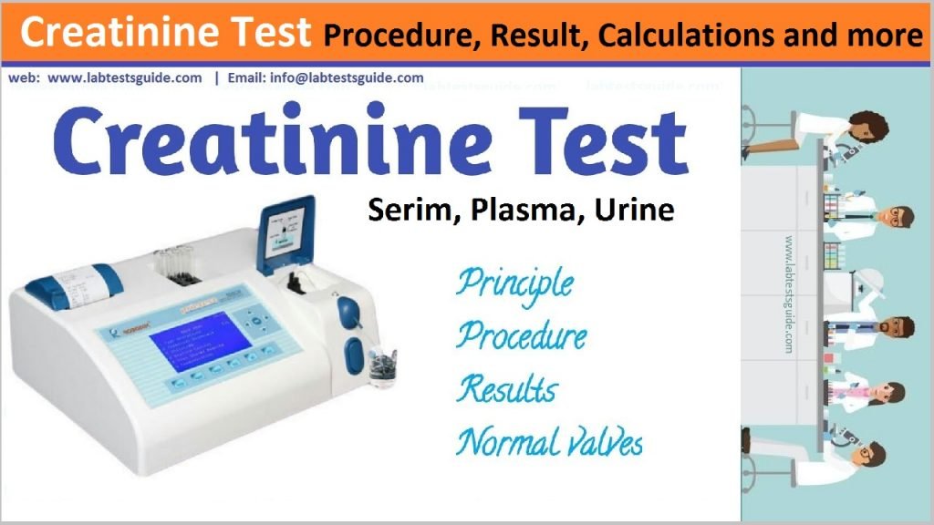 Creatinine Test Procedure Lab Tests Guide