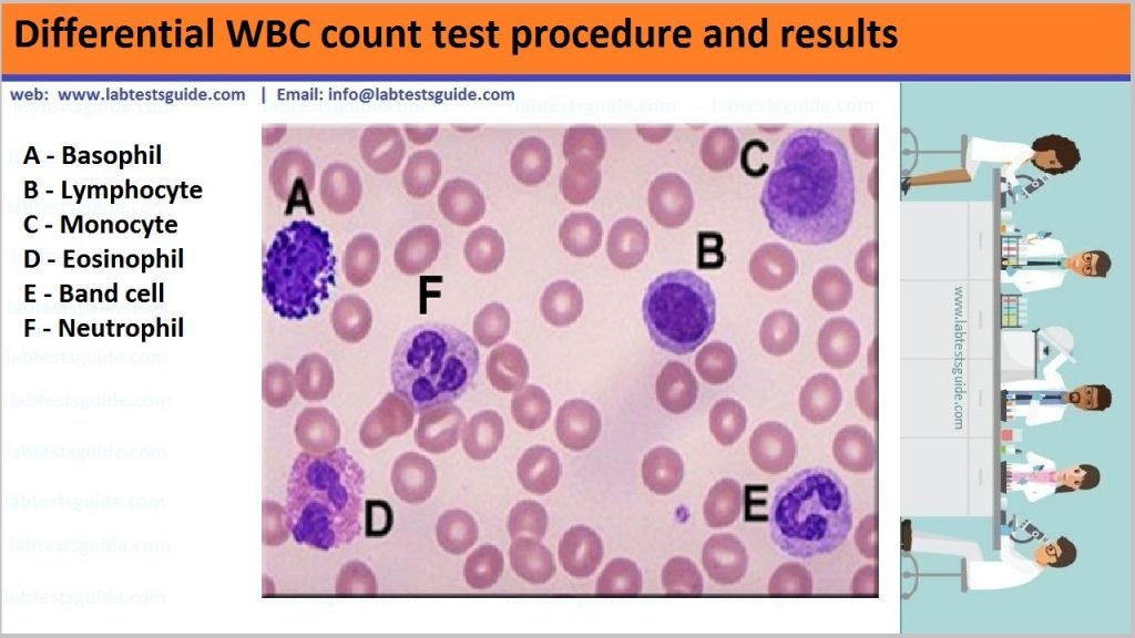 Differential WBC Count Test Procedure Lab Tests Guide