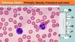 Giemsa Stain Principle, Results, Procedure And More | Lab Tests Guide