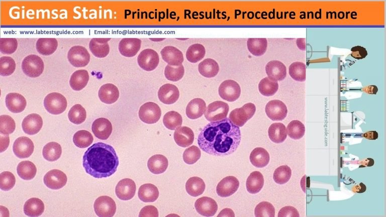 Giemsa Stain Principle, Results, Procedure and more | Lab Tests Guide