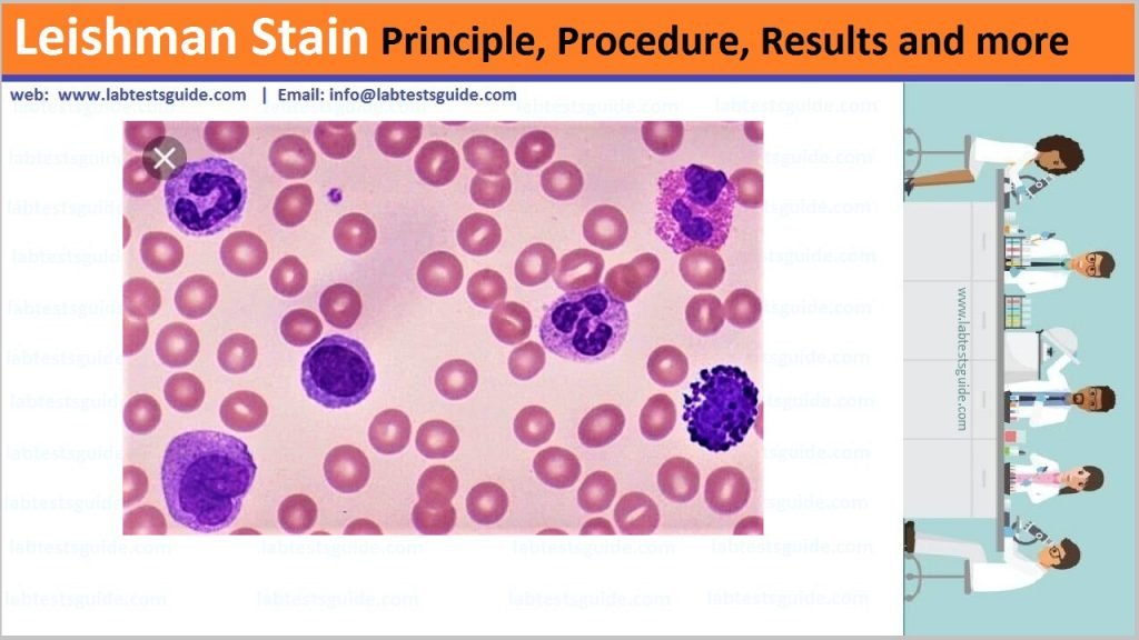 Blood Smear Staining Procedure