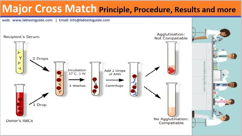 What Is Crossmatching Mean