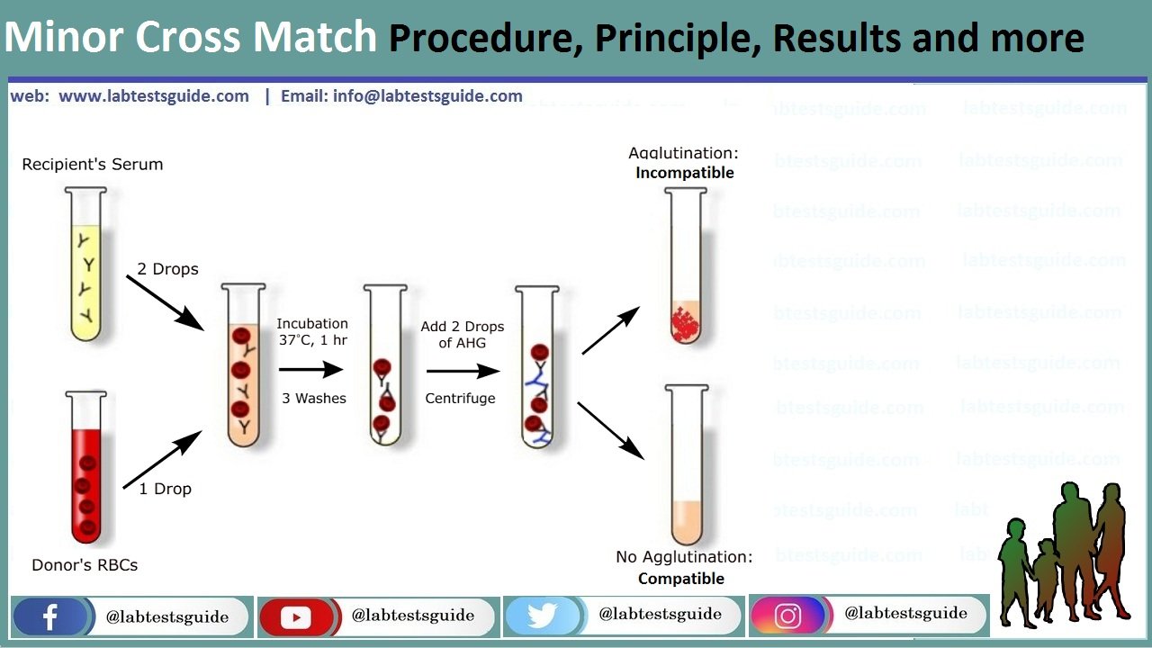 Matching test. Cross Match тест. Cross-Match тест при трансплантации. Cross Match реакция. Кросс матч тест крови.