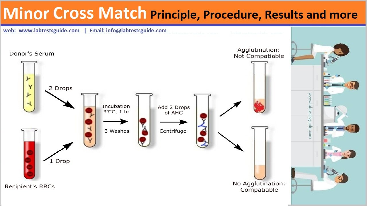 minor-cross-match-procedure-principle-results-and-more-lab-tests-guide