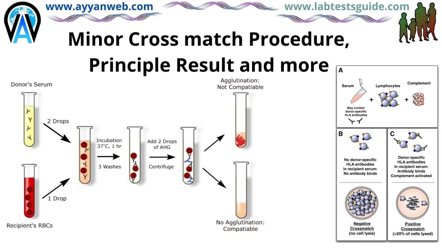 Minor Cross Match Procedure, Principle, Results and more | Lab Tests Guide