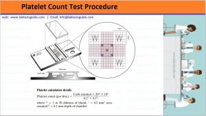 Home Platelet Test