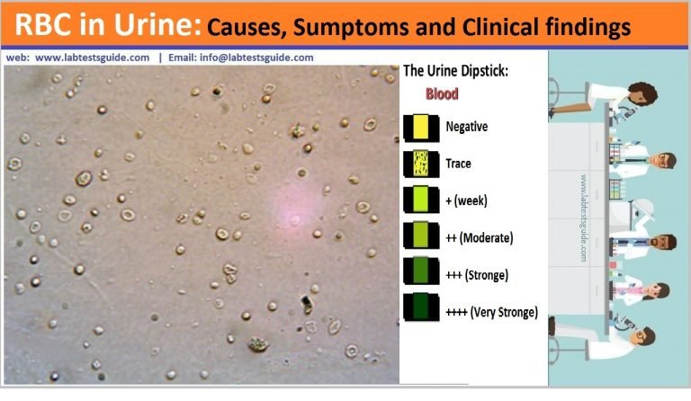 2 5 hpf rbc in urine