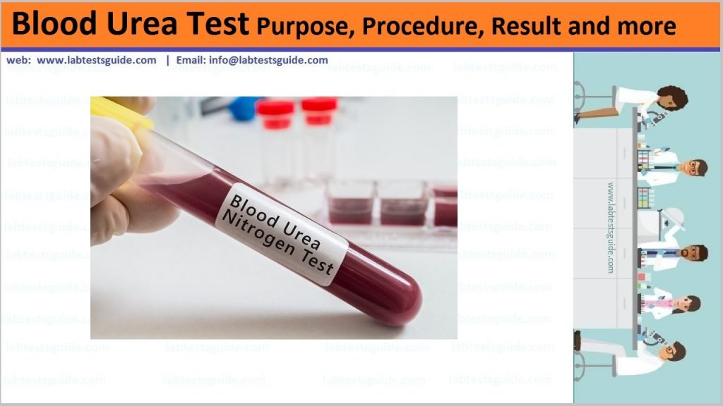 Blood Urea Lab Tests Guide