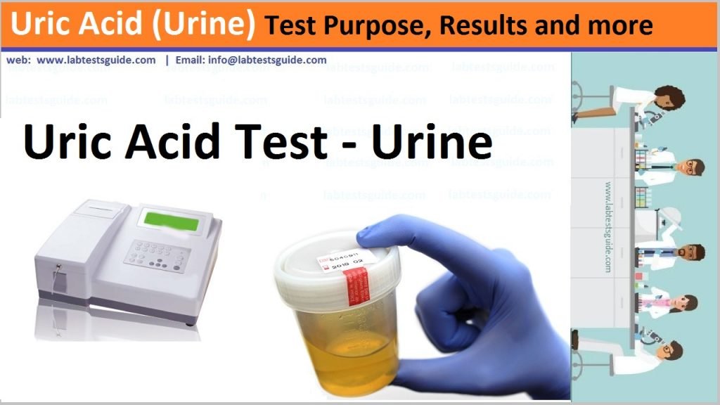 Uric Acid (Urine) Test Purpose, Results and more Lab Tests Guide