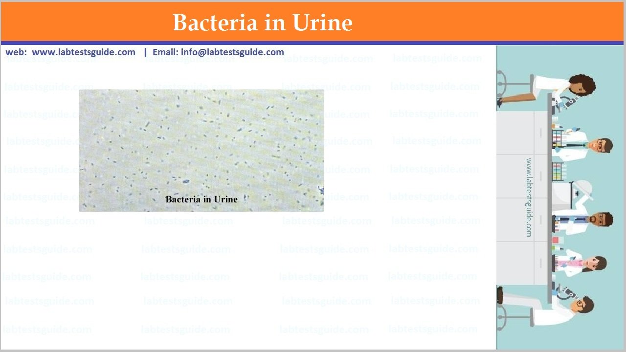 Leukocytes In Urine Causes 3829