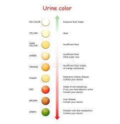 Urine Physical properties Purpose, Results an more | Lab Tests Guide