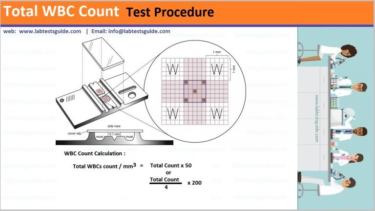 total-leukocyte-count-tlc-test-procedure-lab-tests-guide