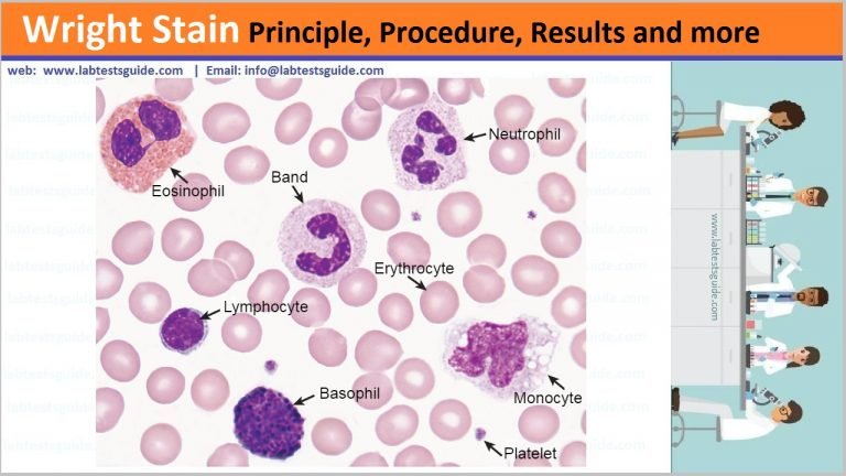 Wright Stain Principle, Procedure, Results And More | Lab Tests Guide