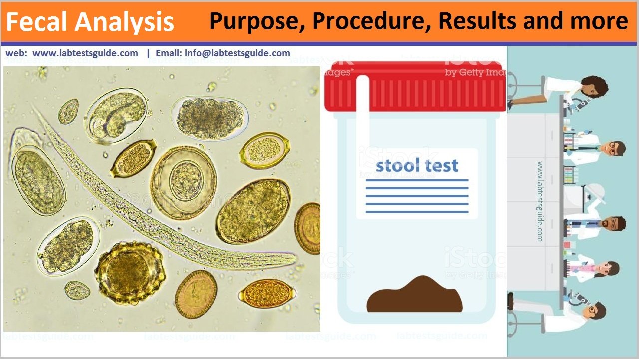 Fecal Analysis Lab Tests Guide