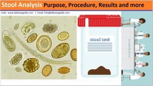 Stool Analysis Purpose, Procedure, Results And More | Lab Tests Guide