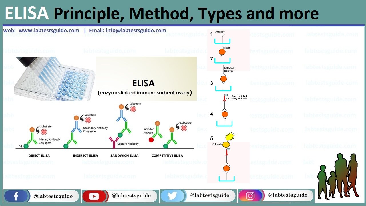 Enzyme Linked Immunosorbent Assay Elisa Types Principle Method And More Lab Tests Guide 8613