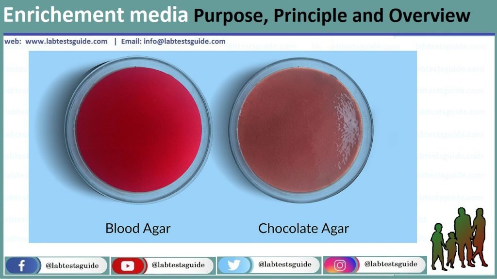 Enrichment Culture Media Purpose, Principle And Overview | Lab Tests Guide